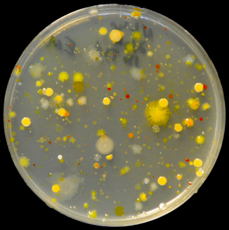 Fertilizer Destroys Plant Microbiome’s Ability To Protect Against Disease...